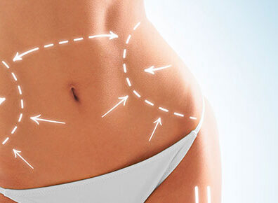 ./lipoaspiracao-396x290_1792356163255